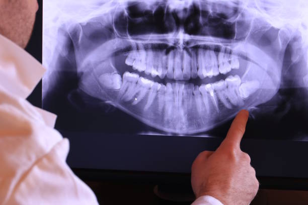 Best Emergency Tooth Extraction in Ammon, ID